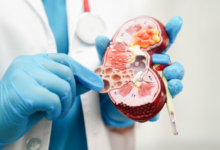 From Salt to Soda: 6 Foods That Secretly Damage Your Kidneys