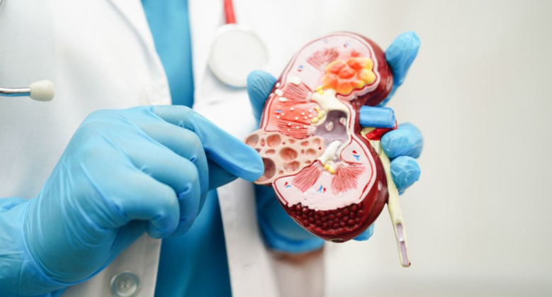 From Salt to Soda: 6 Foods That Secretly Damage Your Kidneys